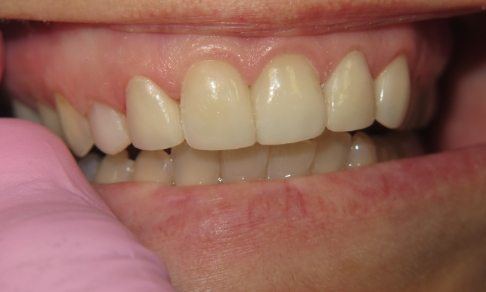 Healthy smile after dental treatment