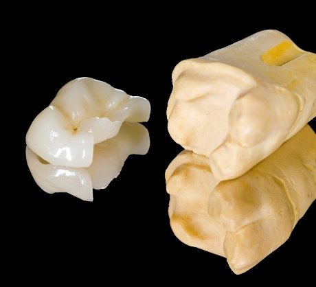 Model tooth with metal free dental crown