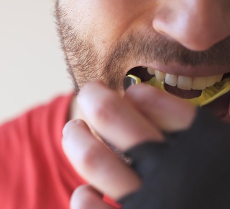 Man with dental implants in Corpus Christi, TX putting in a mouthguard