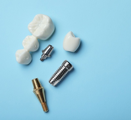 Different parts of dental implants in Corpus Christi, TX
