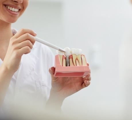Dentist using smile model to explain the four step dental implant process